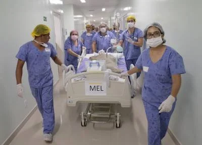 A cirurgia delicadíssima e inédita no DF que separou Mel (foto) e Lis ocorreu em 27 de abril de 2019, no Hospital da Criança de Brasília José Alencar