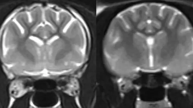 Ressonâncias magnéticas em preto e branco de dois cérebros de gatos. O da esquerda apresenta áreas claras que indicam perda cerebral, enquanto o da direita, de um gato normal, não apresenta essas áreas.