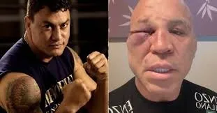 Foto: Reprodução / Redes Sociais