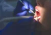 Justiça proíbe definitivamente dentista de realizar cirurgias exclusivas de médicos em Rondônia