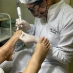 Podologia: cuidado especializado que vai muito além da estética dos pés